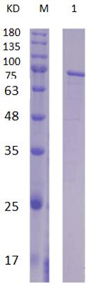15% SDS-PAGE analysis profiles of purified PA0781-32-687 (CBB stained).